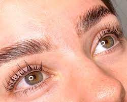 Brow lift Θεσσαλονίκη Brow lift Θεσσαλονίκη